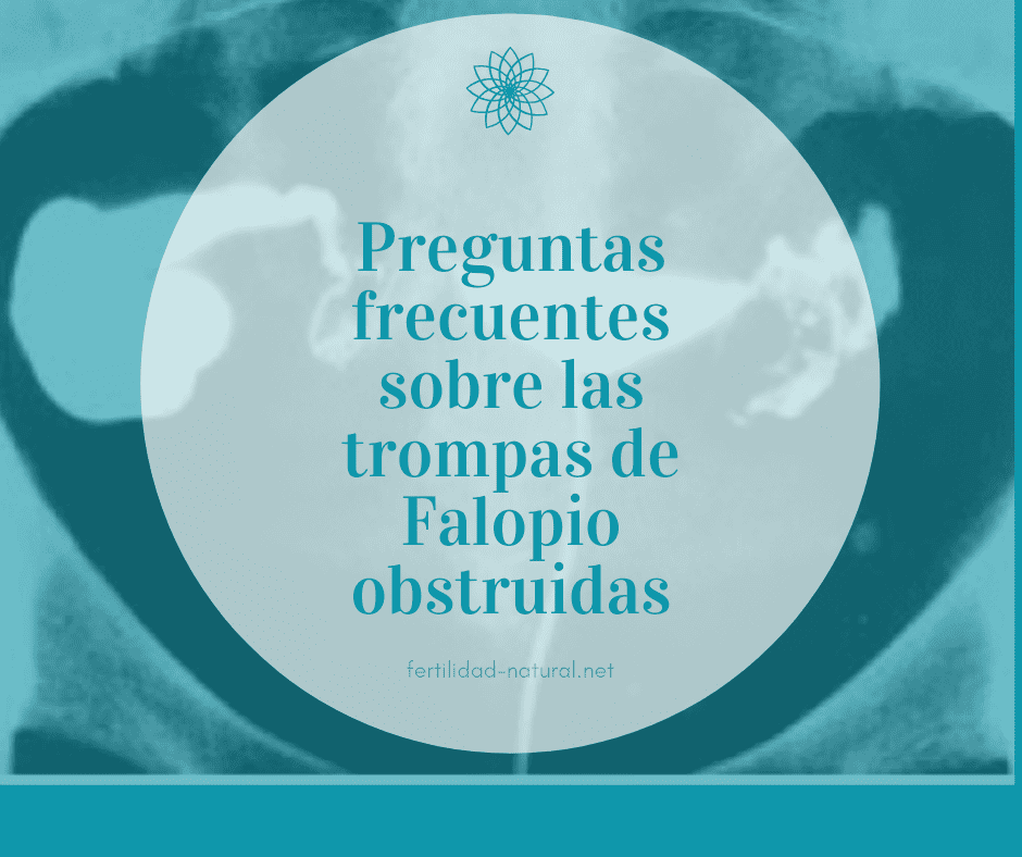 trompas de falopio obstruidas